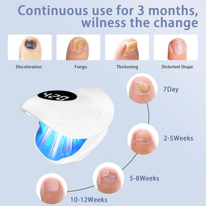 Nail Fungus Laser Device 500NM Blue Light + 940NM Infrared Laser - Wireless Cold Therapy for Onychomycosis Toenail Fingernail Ca