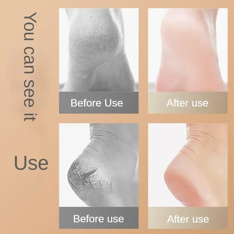 2Pcs Heel Protective Foot Cover Foot Heels Socks Silicone Anti-Crack Moisturizing Socks Unisex Pain Relief Feet Care Sock Black